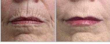 GOLDEN SERUM for Skin tightening, firming and sagging 20% Argireline, DMAE, APT (Red marine Algae), Pepha tight, Hyaluronic acid, Vitamin A (Retinol) Beauty & Personal Care True Radiance