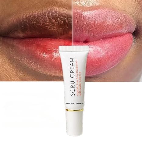 Lip Lightening for Dark Lips Lip Brightener for Smokers Dark Lip Treatment Lightening Cream for Pink Lips Lip Lightener for Smoker Lips Lip Lightening Beauty and Personal Care Rocet