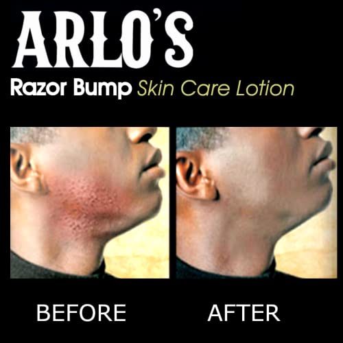 Arlo's Razor Bump Skin Care Lotion 6 oz. Beauty & Personal Care Arlo's