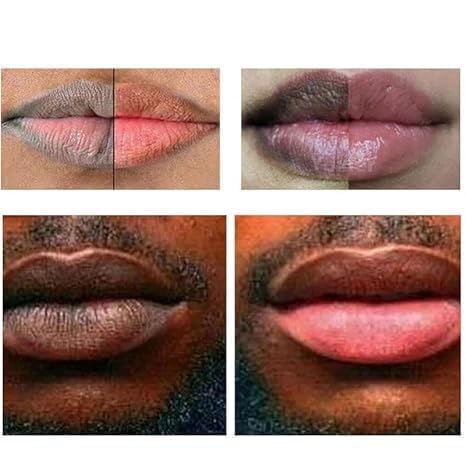 2PCS Lip Lightening Balm Dark Black Removal Exfoliation Pigmentation Fade Dull Pink Balm Anti-Crack Moisturizing Nourishing Lip Care Smokers Beauty and Personal Care Pozggoy