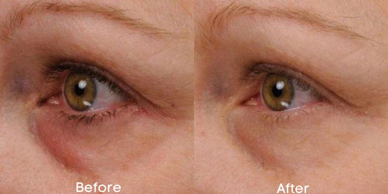Replere Renew & Firm Eye Serum - Under Eye Brightener & Lightweight Serum for Dark Circles and Puffiness - Anti-Aging Wrinkle Repair with Hyaluronic Beauty & Personal Care Replere