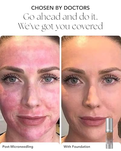 Oxygenetix Oxygenating Foundation - Tawny | Breathable Makeup for Face | Buildable Coverage with Weightless Feel | Longwear Foundation for Women | Beauty & Personal Care Oxygenetix