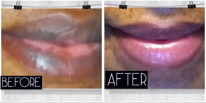 Beauty & Personal Care/ Skin Care/ Lip Care/ Night Treatment/ Lip Repair/ Balm Beauty and Personal Care Lip Tease by Dallace