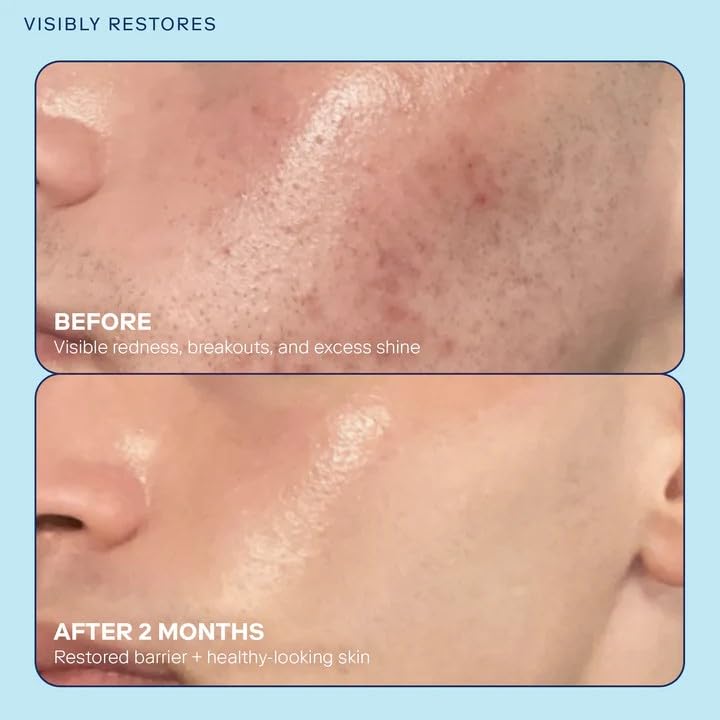 Skinfix Barrier+ Skin Barrier Restoring Gel Cream Mini - 0.5 oz - Hydrating Face Cream for Dry Skin - Strengthens, Visibly Plumps & Firms Beauty & Personal Care Skinfix