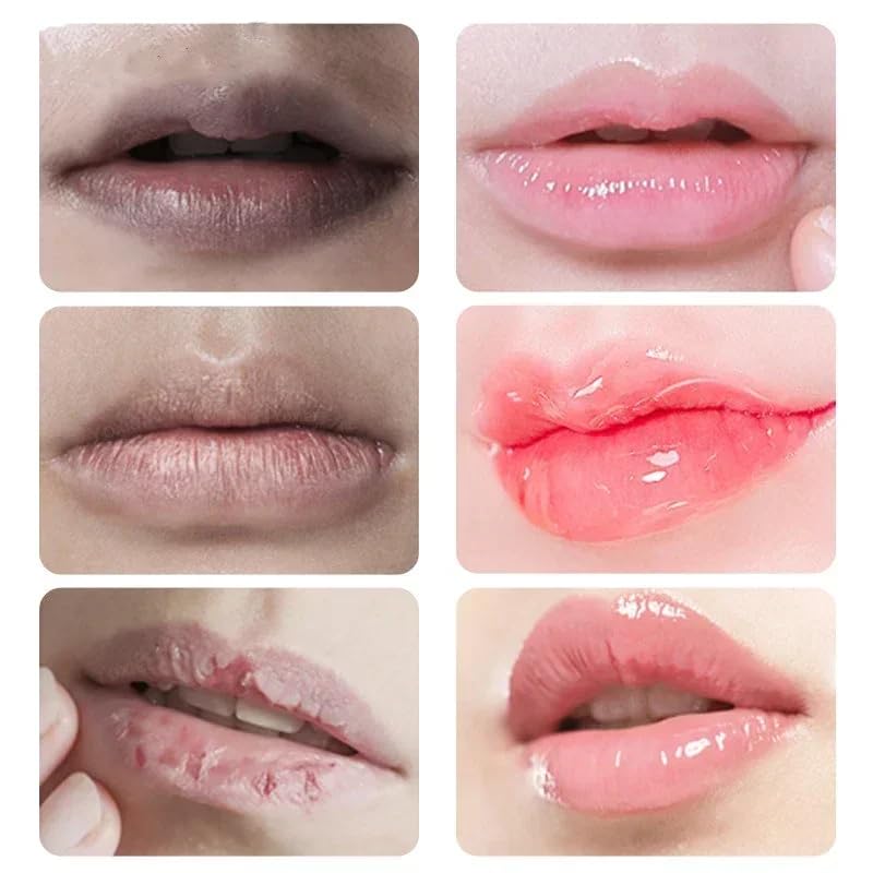 2PCS Lip Lightening for Dark Lips Lip for Smokers Dark Lip Treatment Lightening Cream for Pink Lips Lip Lightener for Smoker Lips Lip Lightening balm Beauty and Personal Care MSECVOI