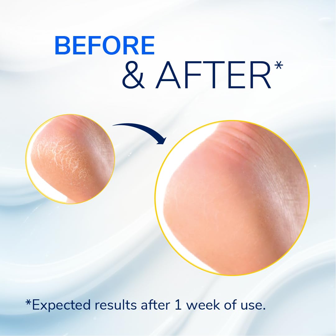 Dr. Scholl's Severe Cracked Heel Repair Restoring Balm 2.5oz, with 25% Urea for Dry, Cracked Feet, Heals and Moisturizes for Healthy Feet Beauty and Personal Care Dr. Scholl's