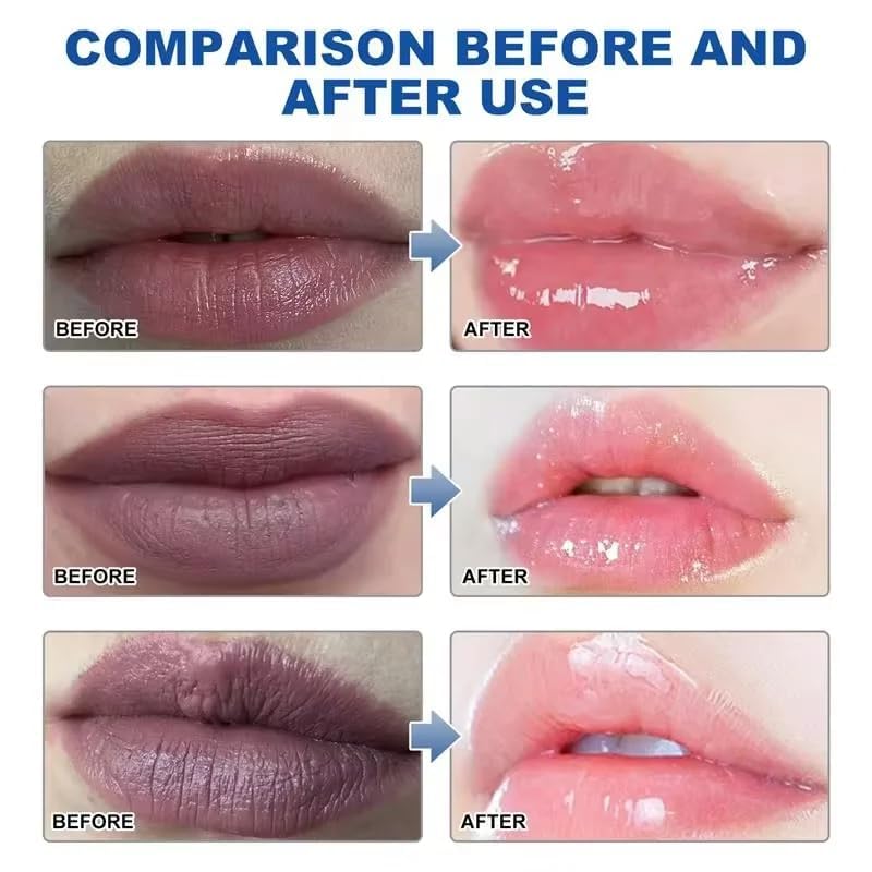 2PCS Lip Lightening for Dark Lips Lip for Smokers Dark Lip Treatment Lightening Cream for Pink Lips Lip Lightener for Smoker Lips Lip Lightening balm Beauty and Personal Care MSECVOI