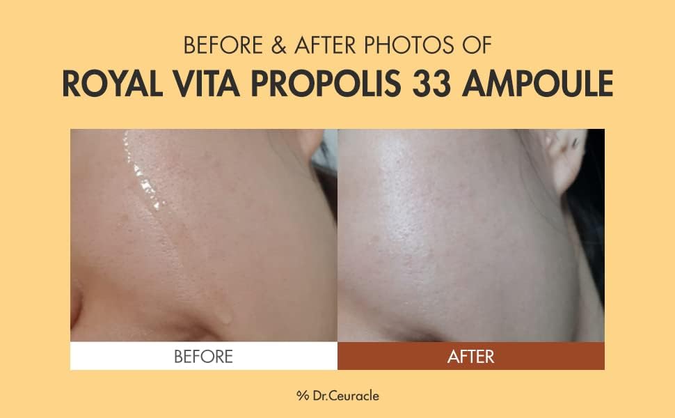 Dr.Ceuracle Royal Vita Propolis 33 Ampoule (30ml / 1.01 fl. oz.) - Ultimate Glow and Nourish Vitamin Serum for Radiant Skin, Formulated with Propolis Beauty & Personal Care Dr. Ceuracle