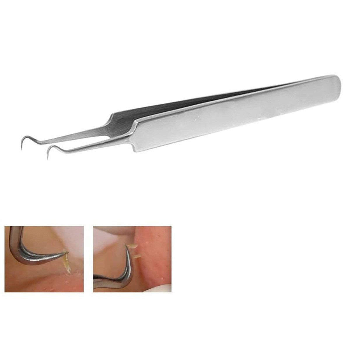 BEUKING Acne Blemish Blackhead Comedone Stainless Steel Nipper Blemish Extractor Tool for Remove Blackhead Acne Whitehead Pimple Bend Curved Tweezers Beauty & Personal Care BEUKING