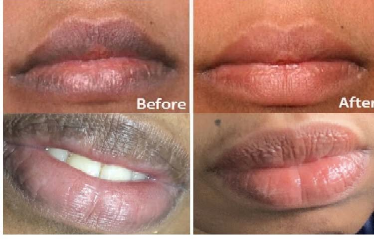 H.D.S.N. 2PC Lip care Of Lips Pink Fresh Lightening Bleaching Cream Treatment Remove Dark Smoke Lips lip oil (green) Beauty and Personal Care H.D.S.N.