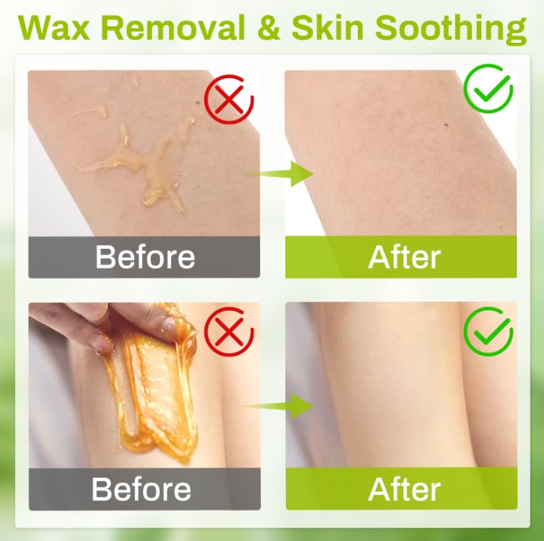 RAQEHO 20PCS Post Wax Wipes - After Waxing Calming Oil Wipes Post Wax Care for Body Facial Waxing Remover Aftercare Product for Hair Removal After Wax Beauty and Personal Care RAQEHO