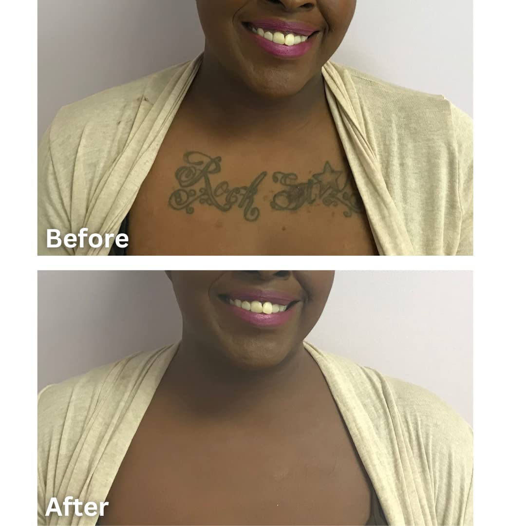 Dermaflage Tattoo Cover Up Makeup (Dark) - Bruise Full Coverage Concealer - Full Coverage Waterproof Concealer for Bruise, Scars & Acne - Smudge Proof Beauty & Personal Care Dermaflage