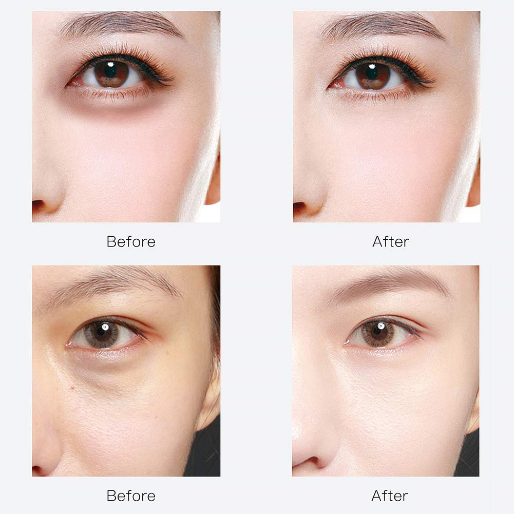 RABIOTA Under Eye Patches,30 pairs Hyaluronic Acid Anti-Aging Under Eye Mask, Collagen Under Eye Gel Pads for Dark Circles, Wrinkles, Fine Line Beauty & Personal Care RABIOTA