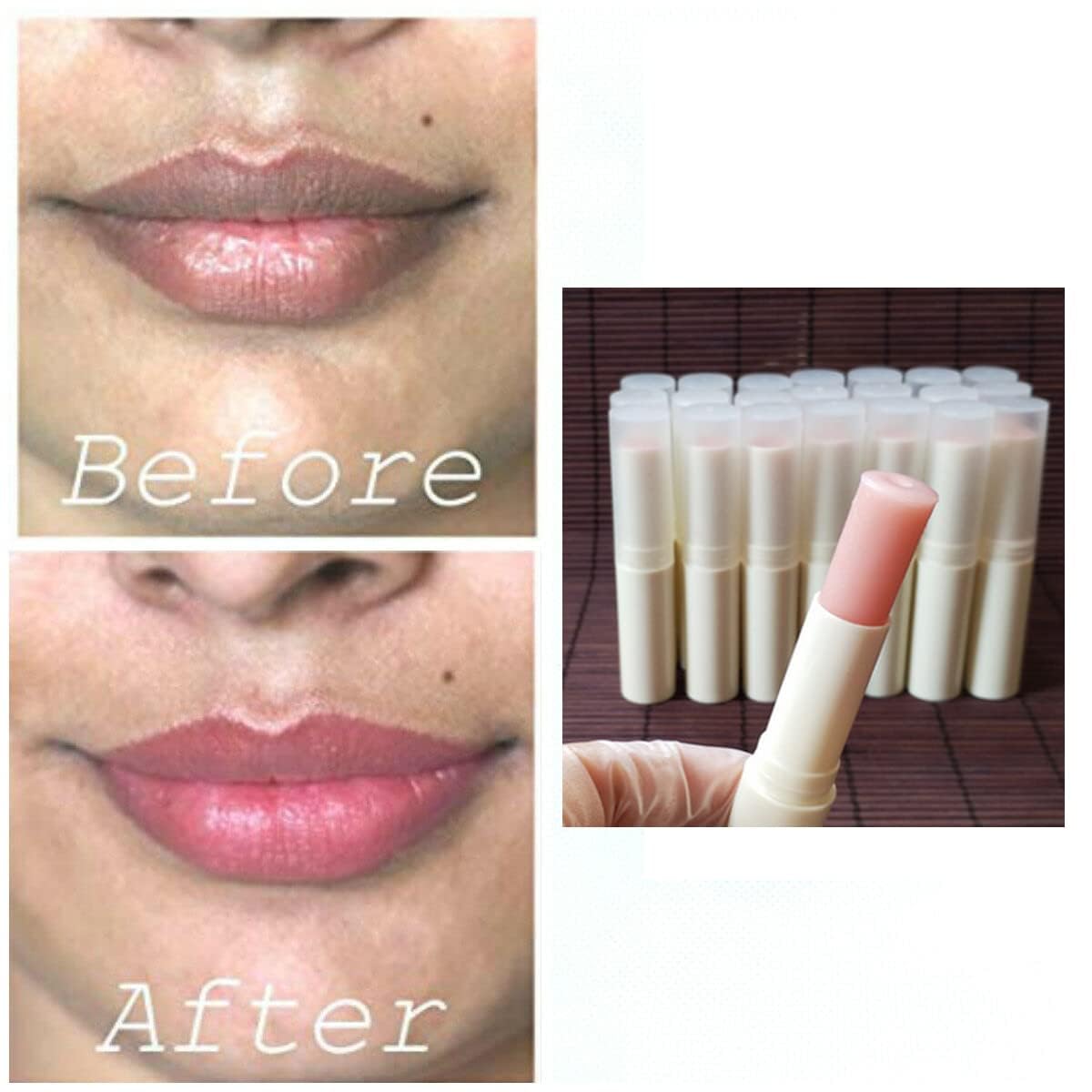 2PCS Natural Plant Lip Balm for Dark Lips,Exfoliating Lip Scrub, Moisturizing Lip Hyaluronic Acid Exfoliating Dead Skin, Lip Balm for Smokers, Restore Beauty & Personal Care LCRORO