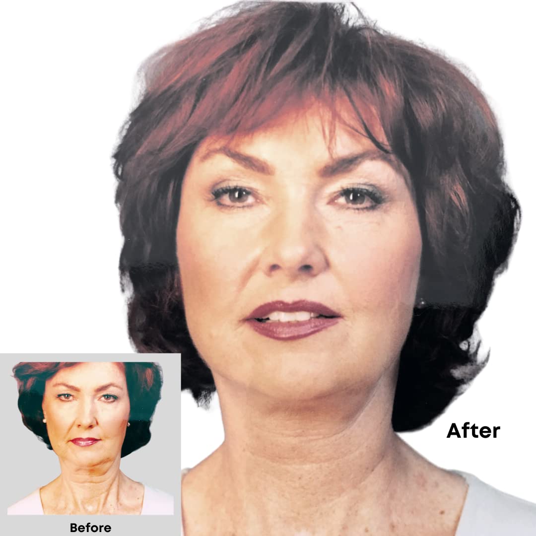 Bring It Up Instant Face Lift Tape Kit: 30-Day Supply, Transparent Neck & Eyebrow Lift Strips, Anti-Wrinkle Stickers, Face Tape Instantly Lifts Beauty & Personal Care Bring It Up