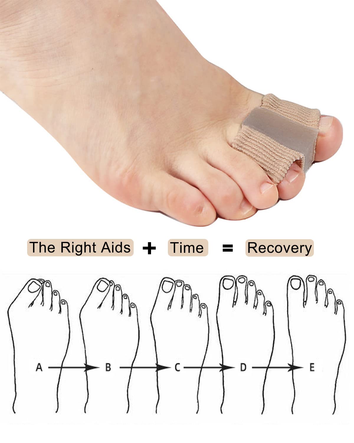 Golbylicc Bunion Toe Separators for Overlapping Toes Women Men, Gel Toe Spacers Bunion Corrector with 2 Loops for feet, Hammer Toe Straightener (2PC) Beauty and Personal Care Golbylicc