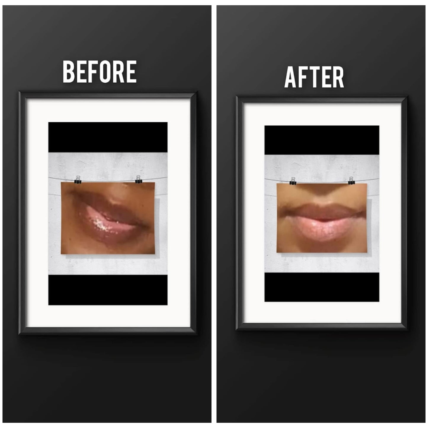 Beauty & Personal Care/ Skin Care/ Lip Care/ Night Treatment/ Lip Repair/ Balm Beauty and Personal Care Lip Tease by Dallace