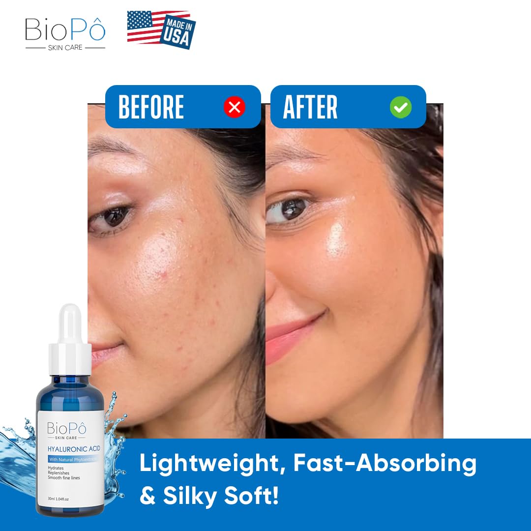 Hyaluronic Acid Serum 30 ml - Hydrating and Anti-Aging, Smooths Fine Lines, Replenishes Skin, Pure Hyaluronic Acid for Face & Skin - Suitable All Skin Beauty & Personal Care BioPo
