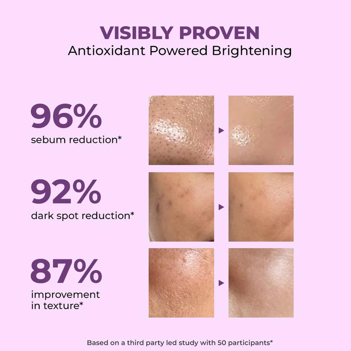 Conscious Chemist® Niacinamide Face Wash | 100ml | Pore Refining & Brightening Cleanser for Men & Women | With Blueberry & Açaí Berry Extracts | All Beauty & Personal Care Conscious Chemist
