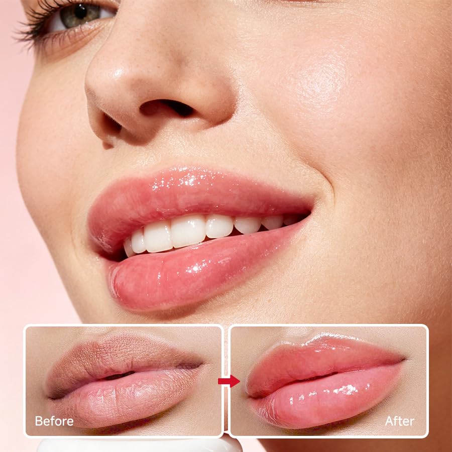 RYDEEN Watermelon Lip Butter Balm, Moisturizing Lip Treatment, Watermelon and Strawberry, 0.28 oz Beauty and Personal Care RYDEEN