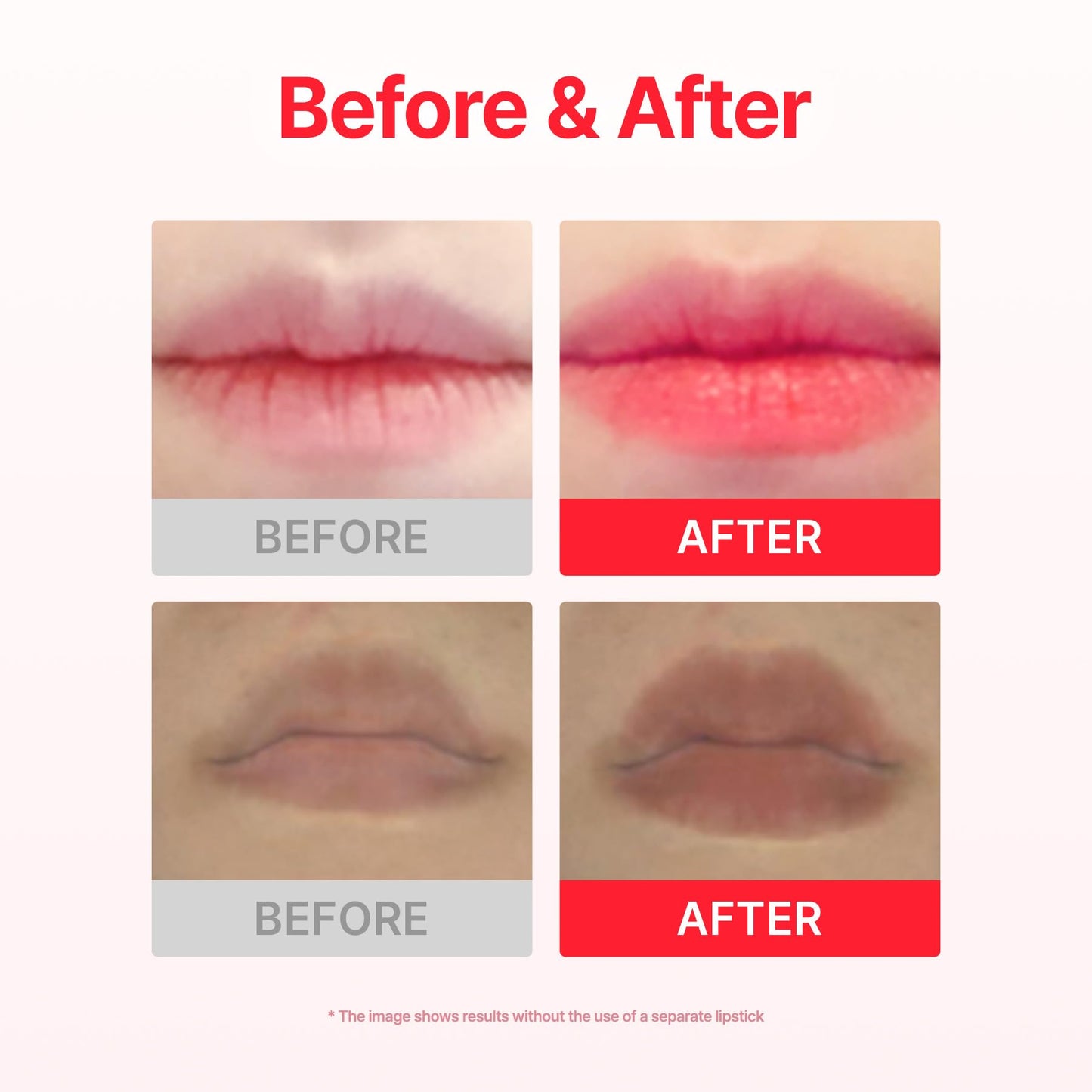 ACROPASS Jolly Filly Lip Patch, Helps Improve the Look of Smooth, Moisturized Lips, 30Minute Hydrating Lip Care with Cayenne Fruit Extract (2 Patches) Beauty and Personal Care Acropass