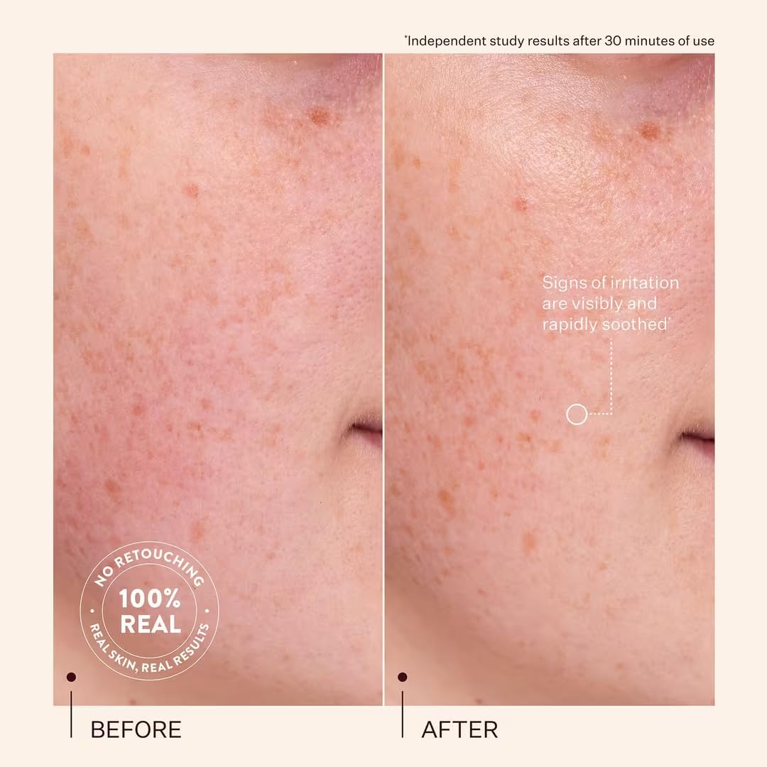 Peach & Lily Rescue Party Barrier Restore Serum Beauty & Personal Care Peach & Lily