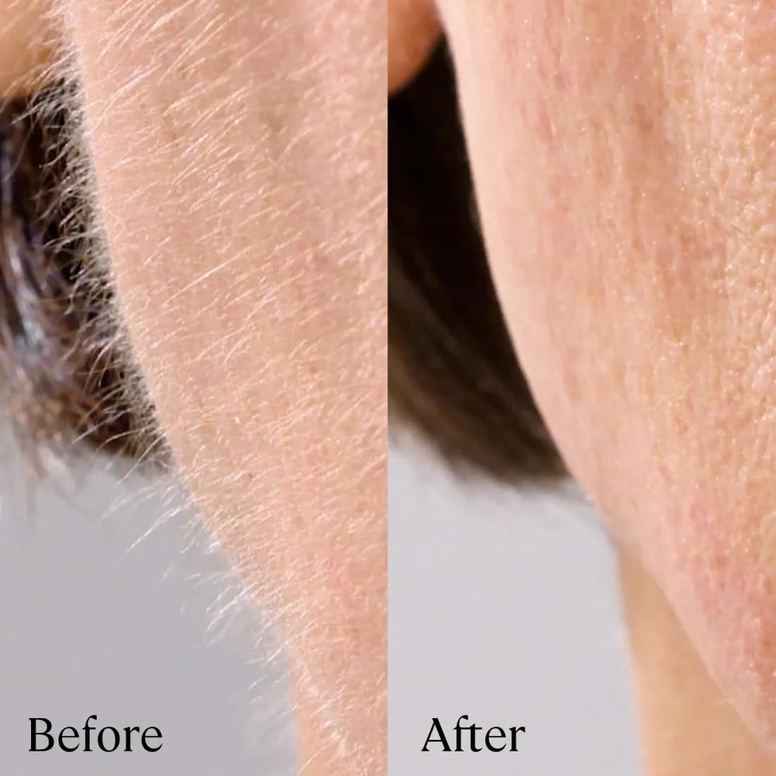 Michael Todd Beauty - Sonicsmooth Pro+ Dermaplaning Blade Refills - 8 Dermaplaning Blades- 2 Month Supply - Device Not Included Beauty & Personal Care MICHAEL TODD