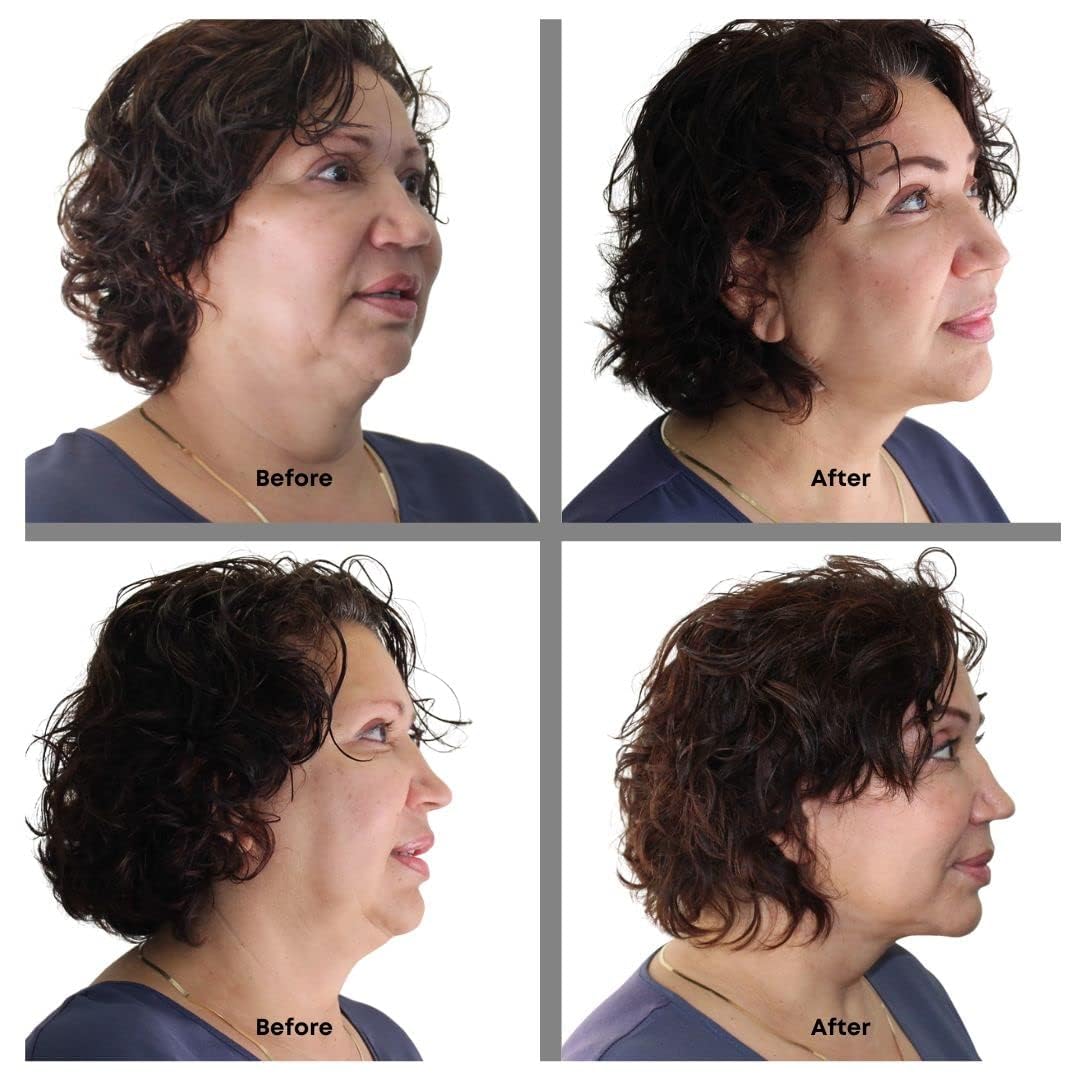 Bring It Up Instant Neck Lift Tape 30 Day Supply, Transparent Neck Lifting Anti Wrinkle Stickers - Tones Sagging Necklines Instantly - Made in USA Beauty & Personal Care Bring It Up