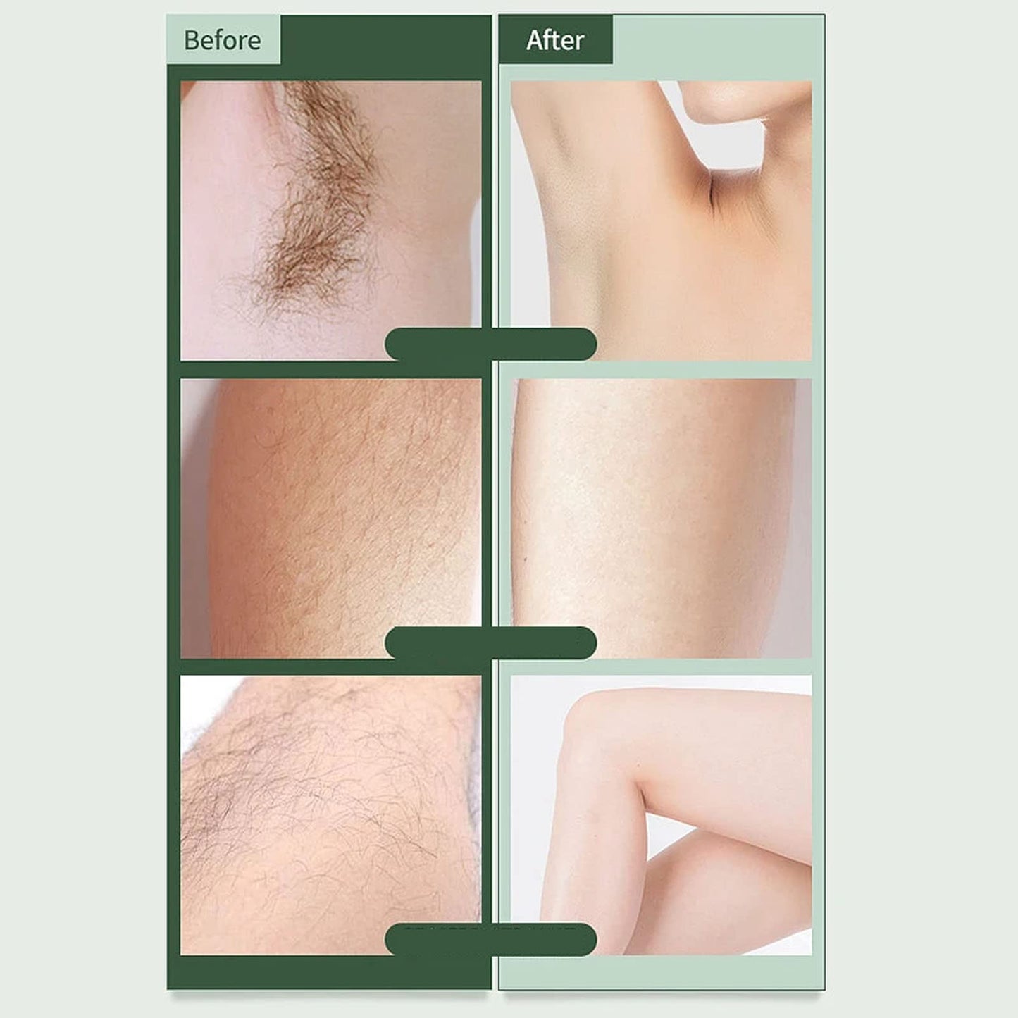 Yinhing Electric Bikini Shaver with LED Light, Electric Epilator, Electric Shaver for Women, Body Hair Trimmer, Body Depilator, Eyebrow Trimmer, Hair Beauty and Personal Care Yinhing