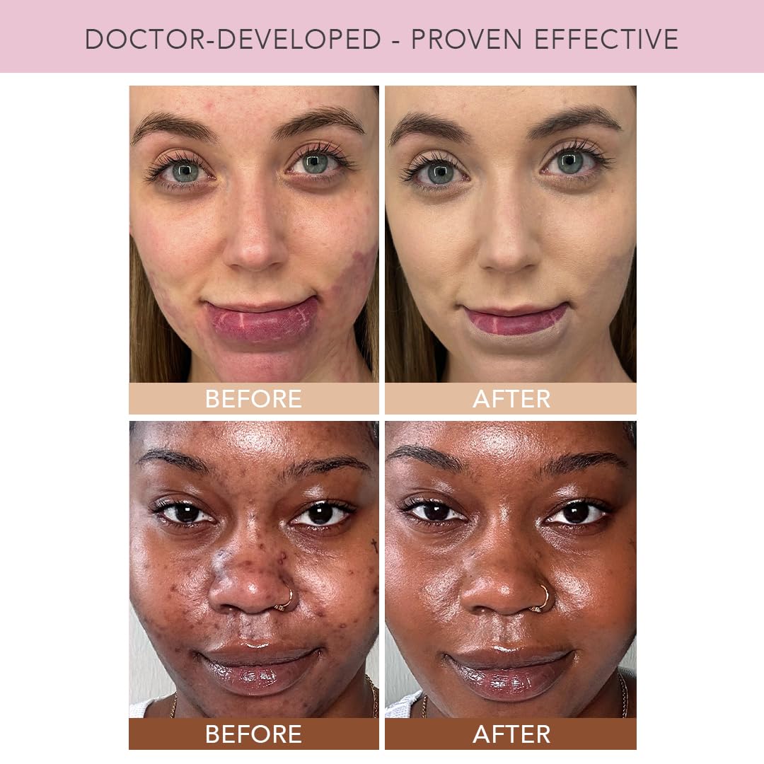 DOLL 10 TCE Liquid Filter - CC Cream - Liquid Foundation - Lightweight Tinted Moisturizer & Skin Tint - Blurs Pores & Fine Lines - Vegan - Clean