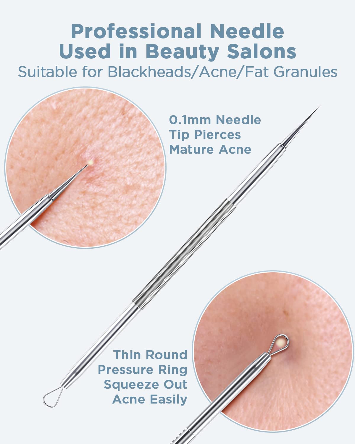 BESTOPE Blackhead Remover Blackhead Removal Pimple Comedone Extractor Tool - Treatment for Blemish Whitehead Popping Zit Removing with Metal Case Beauty & Personal Care TAYTHI