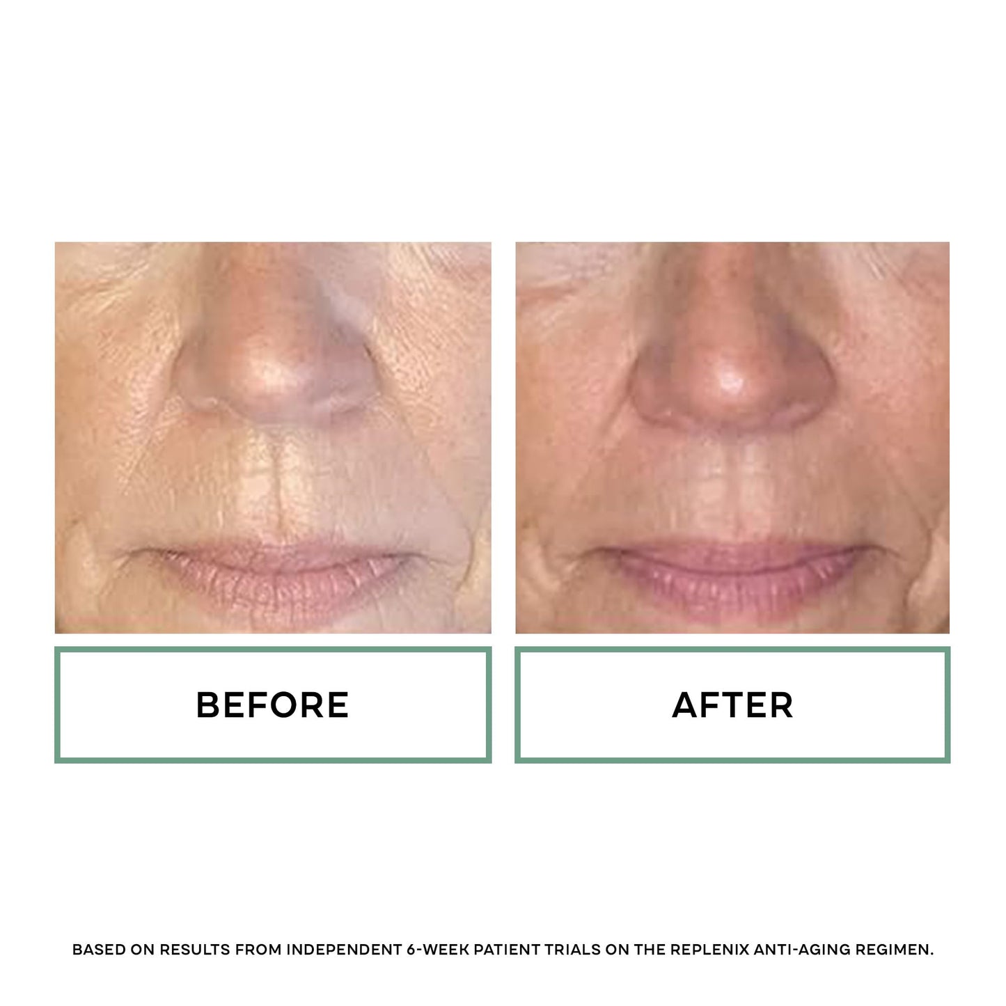 Replenix Age Restore Nighttime Therapy Face Cream, Anti-Aging Medical-Grade Facial Moisturizer for Mature & Dry Skin (0.5 fl oz) Beauty & Personal Care Replenix