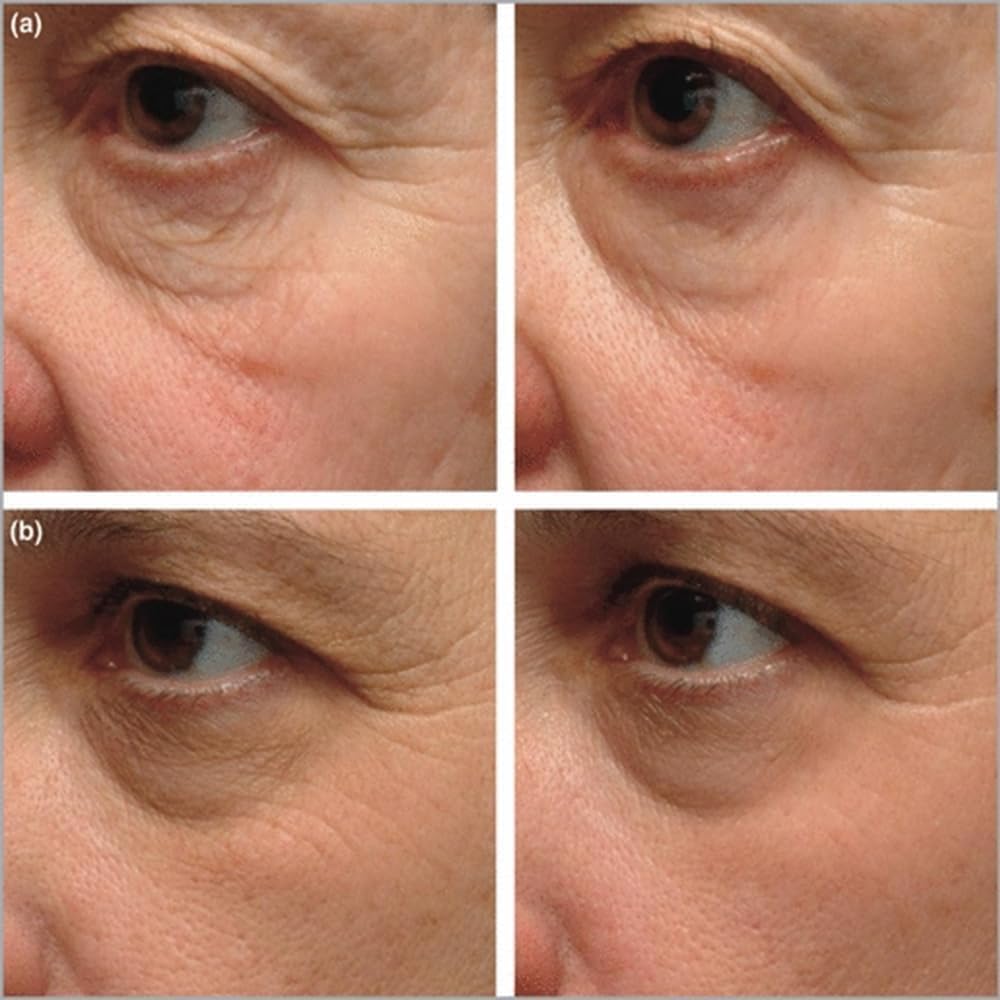 Instant Firming Eye Serum|Anti-Aging Formula for Under Bags and Wrinkles, Under Eye Cream-10ml, Wrinkle Filler, Visibly Improves for Bags Dark Circles Beauty & Personal Care HEQIFU