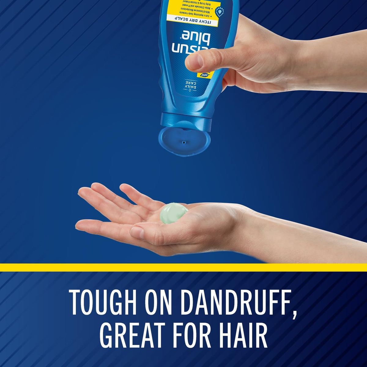 Selsun Blue Itchy, Dry Scalp Antidandruff Shampoo, 11 fl. oz.