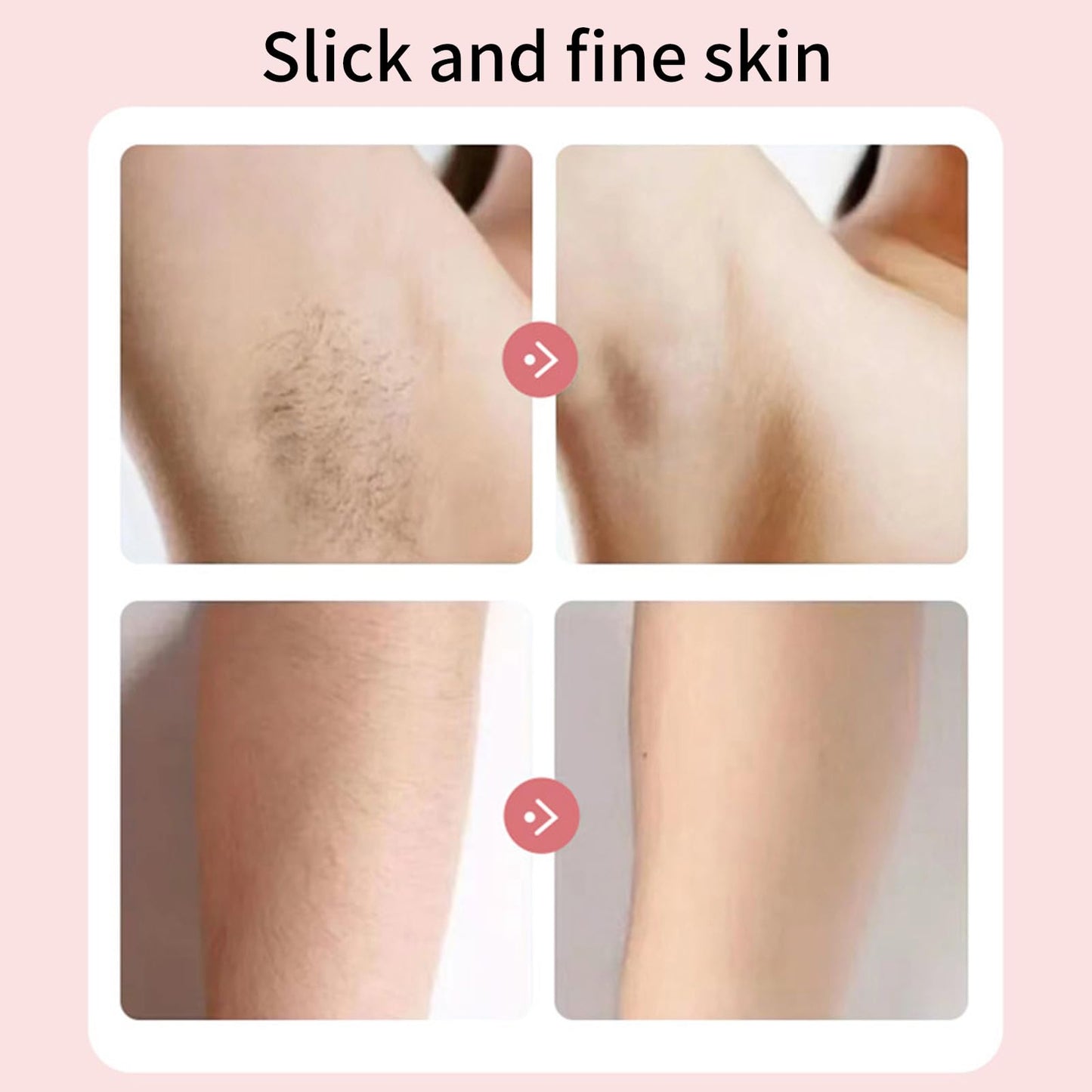 Bikini Trimmer for Women, 3 in 1 Electric Painless Hair Remover IPX7 Body Groomer for Face, Bikini Underarm, Cordless Portable for Travel Beauty and Personal Care Marhynchus