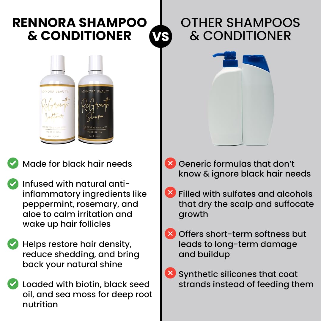 Rennora Hair Growth Shampoo and Conditioner with Organic Shea Butter, Aloe Vera, Argan Oil, Green Tea, Chamomile, Irish Moss, and Vitamin E - No Beauty & Personal Care RENNORA BEAUTY