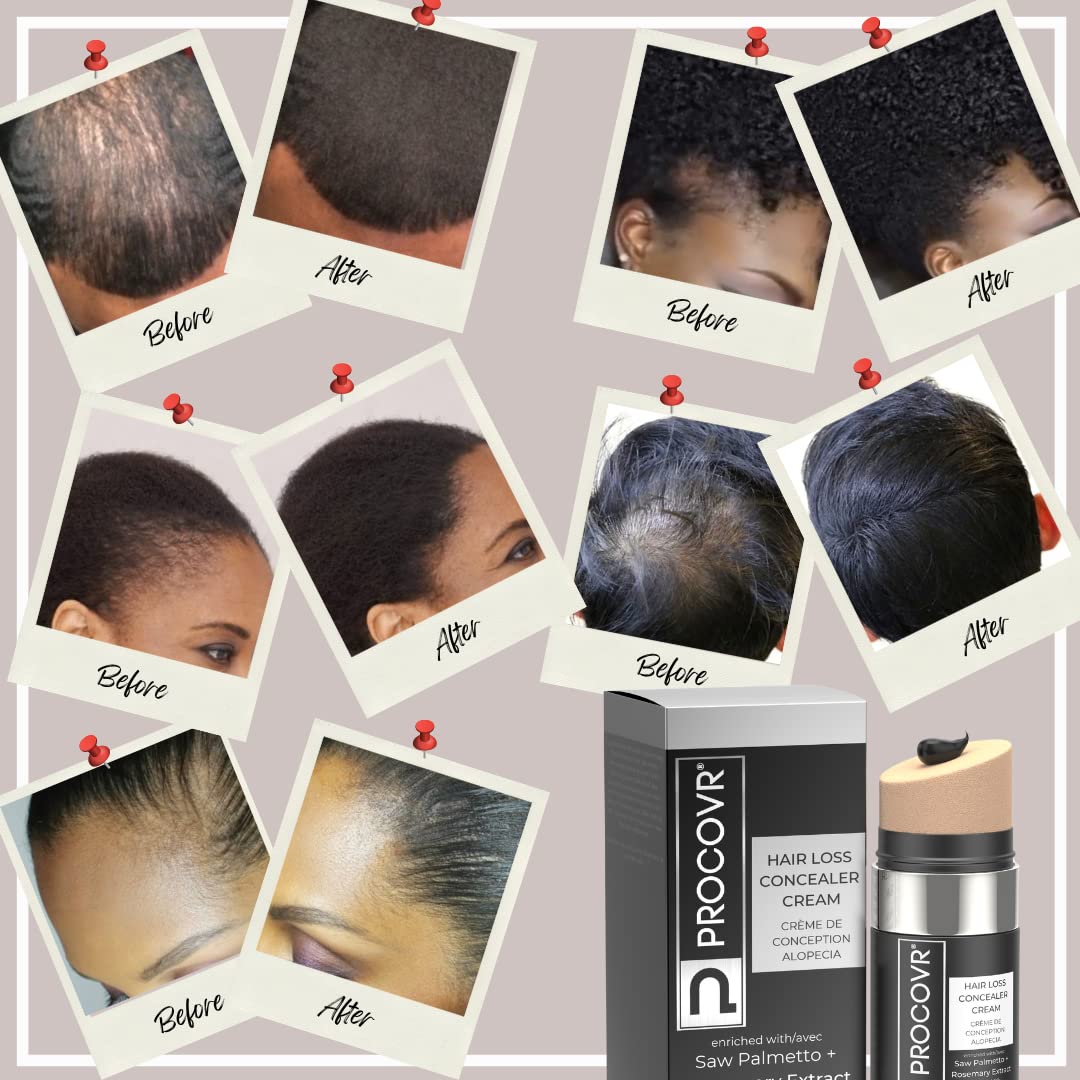 PROCOVR Hair Loss Concealer Cream - The ORIGINAL Thinning & Balding Hairline Enhancer, Hair Mascara for Natural Coverage & Thicker Appearance (Smoke Beauty & Personal Care PROCOVR