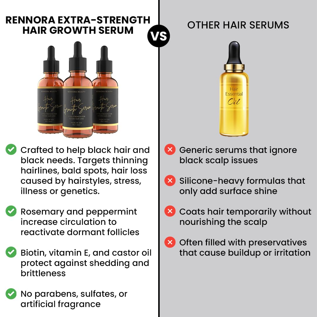 Rennora Extra-Strength Hair Growth Serum, Rosemary & Castor Oil (1 fl oz)