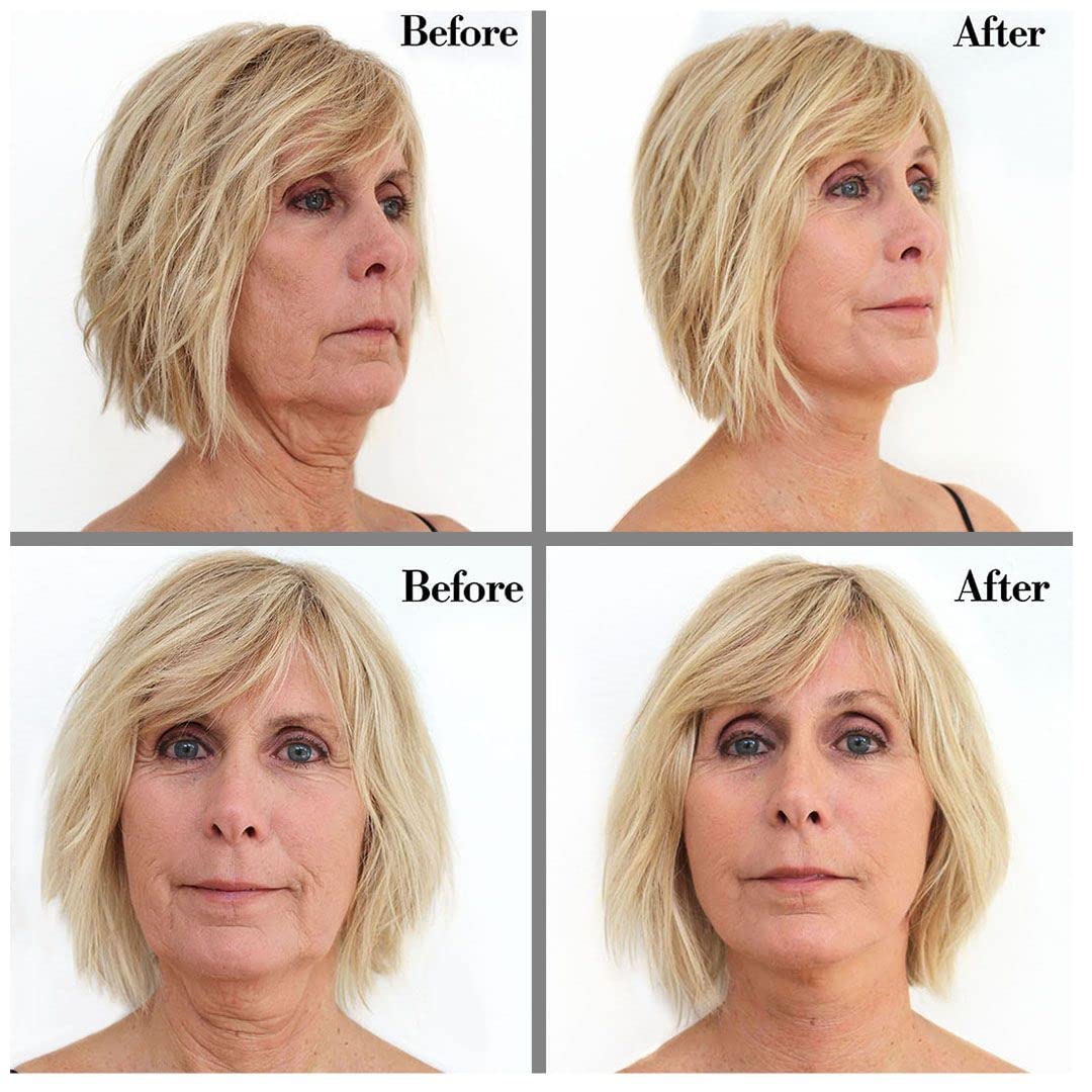 Bring It Up Instant Face Lift Tape Kit: 30-Day Supply, Transparent Neck & Eyebrow Lift Strips, Anti-Wrinkle Stickers, Face Tape Instantly Lifts Beauty & Personal Care Bring It Up