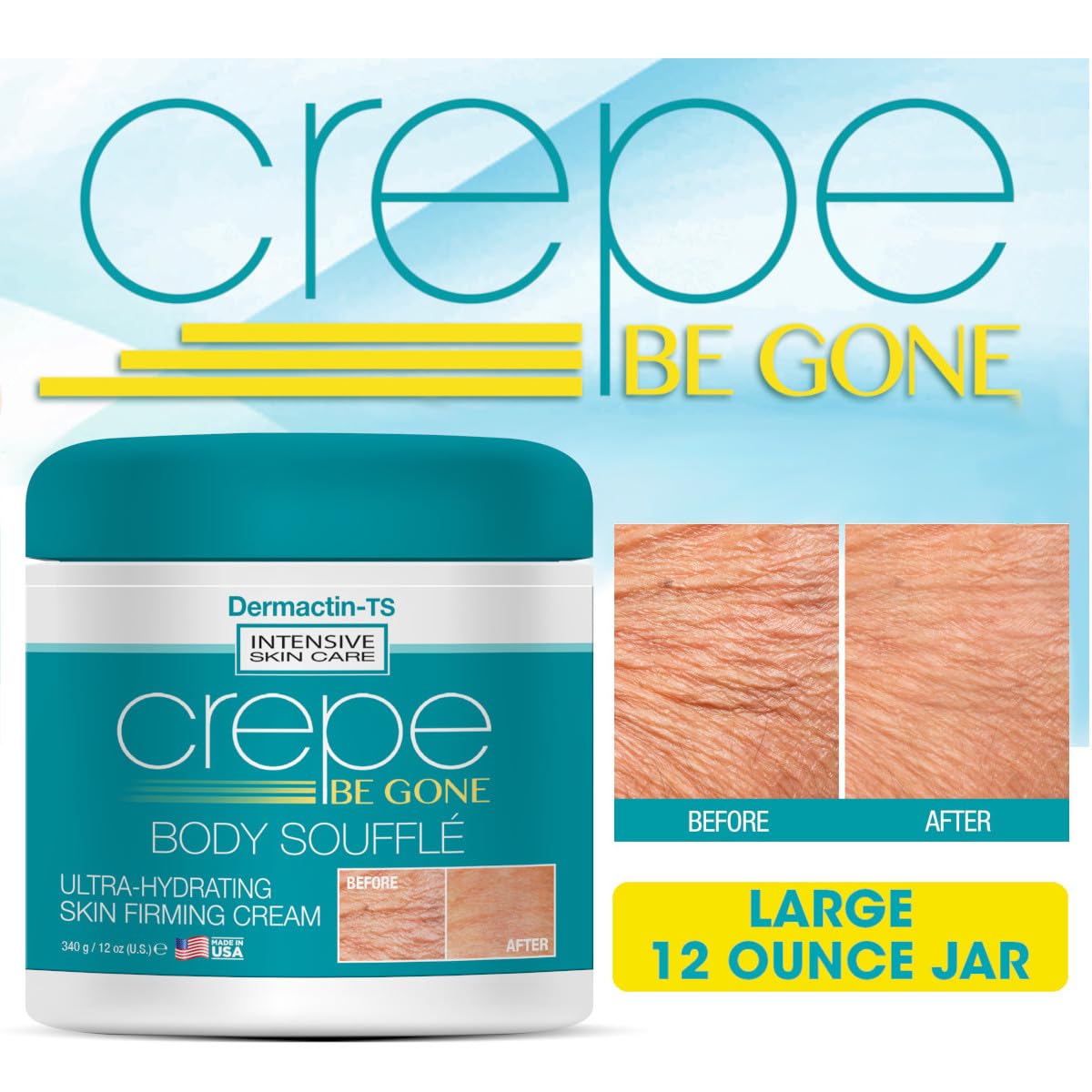 Dermactin Crepe Be Gone Body Souffle Classic - Large 12 ounce - Ultra Hydrating Crepe Skin Firming Cream for Neck,Chest, Arms & Legs
