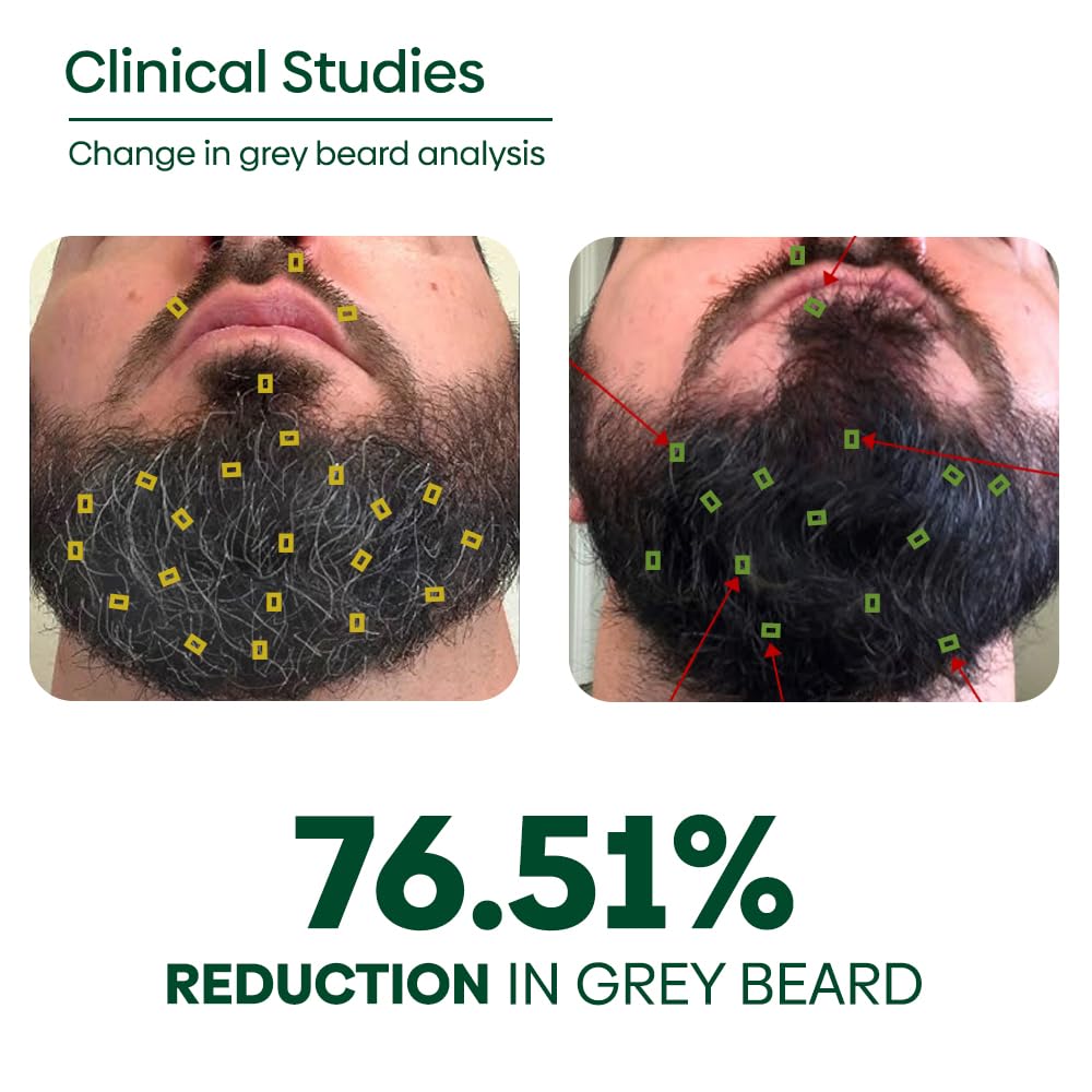 RISHI NATURAL Grey Beard Serum Oil (50ml) Beauty and Personal Care RISHI NATURAL