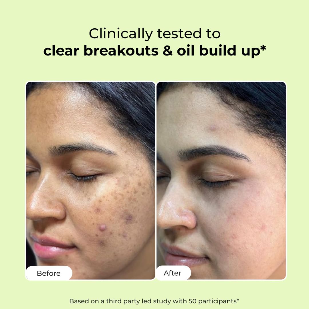 Conscious Chemist® 2% Salicylic Acid Face Wash | 100ml | Face Wash for Oily & Acne Prone Skin for Men & Women, Glycolic Acid & CICA Extract Beauty & Personal Care Conscious Chemist