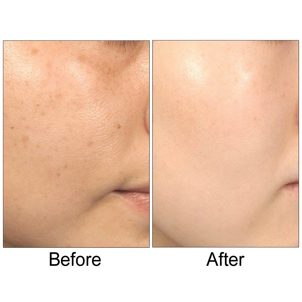Lumetrics with Copuline by Biologic Solutions Diminishing Lines Wrinkles Radiant Skin Complex - 1 oz. Beauty & Personal Care Biologic Solutions