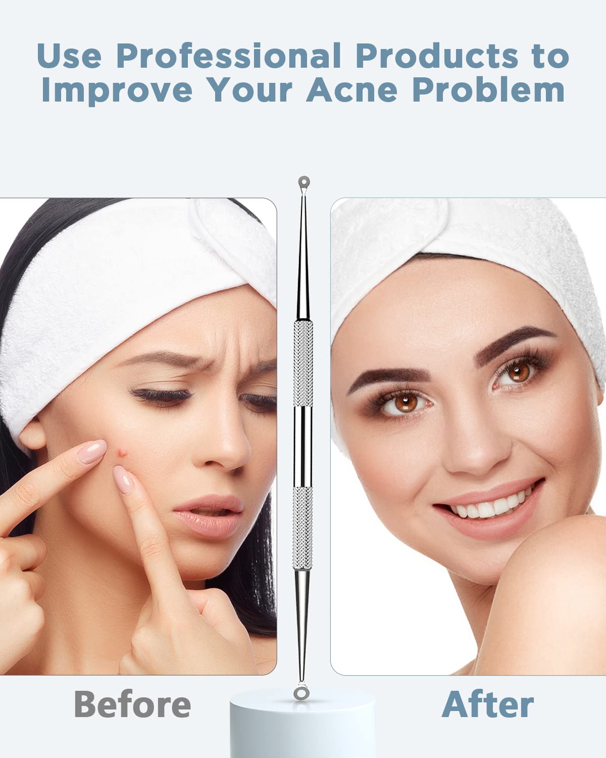 BESTOPE Blackhead Remover Blackhead Removal Pimple Comedone Extractor Tool - Treatment for Blemish Whitehead Popping Zit Removing with Metal Case Beauty & Personal Care TAYTHI