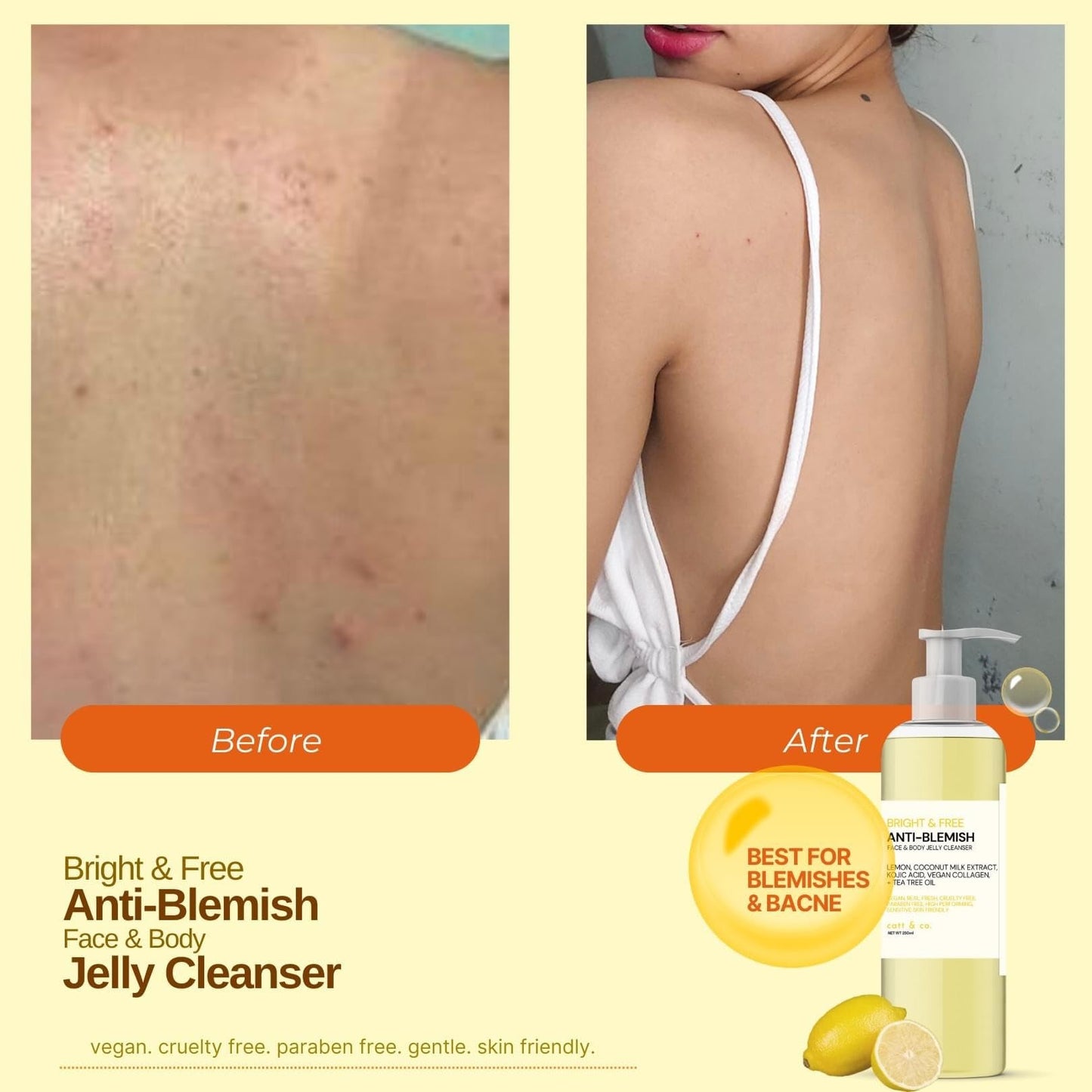 Catt & co. Bright and Free ANTI- BLEMISH FACE & BODY JELLY CLEANSER 250ML Beauty & Personal Care Catt & Co