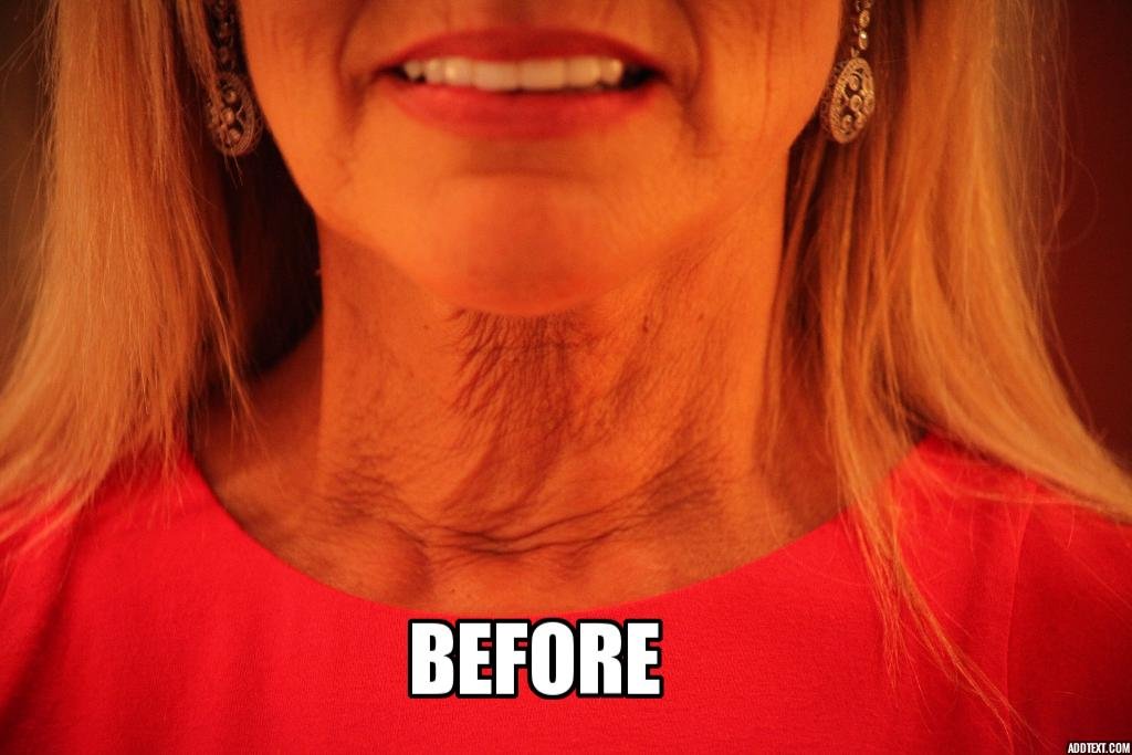 NeckTITE Magic - The Instant Neck Lift Beauty & Personal Care NeckTITE Magic