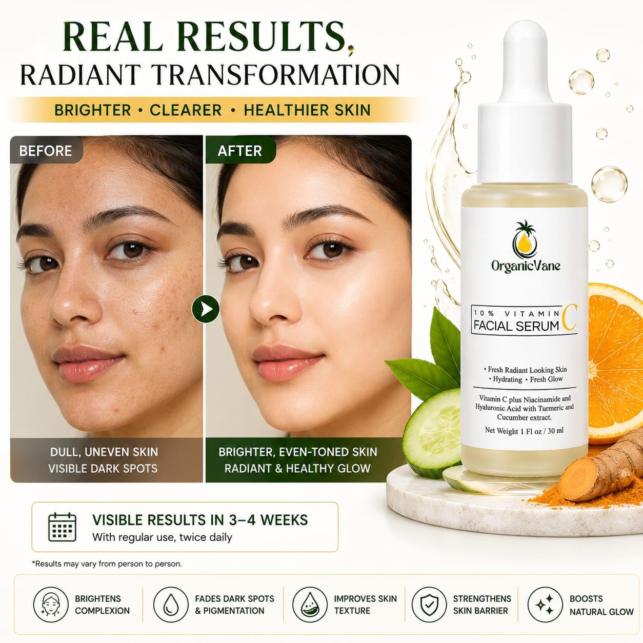 Vitamin C Serum 10% for Face - Powerful Anti-Aging Brightening Serum with Hyaluronic Acid, Niacinamide & Turmeric, Dark Spot Corrector, Reduces Beauty & Personal Care Organic Vane