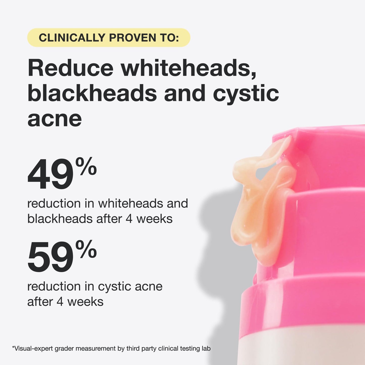 INNBEAUTY Project Acne Serum Medicated Treatment for Breakouts, Blackheads & Oil Control, 1 OZ (30ml) Beauty & Personal Care Innbeauty Project