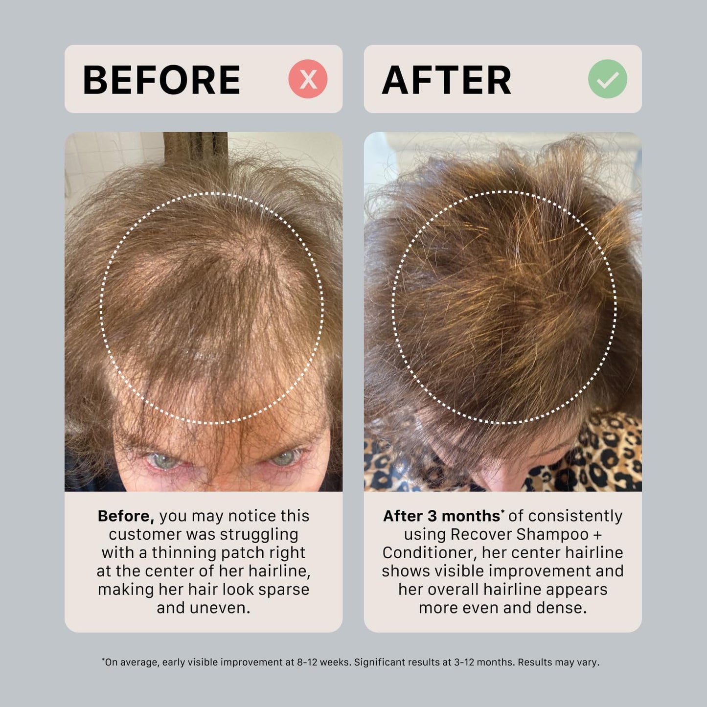 ACTIIV Ultimate Power Trio For Women | Boosts Fuller-Looking Hair, Strengthens, Soothes Scalp, Includes Shampoo, Conditioner & Serum, Vegan Beauty & Personal Care ACTIIV