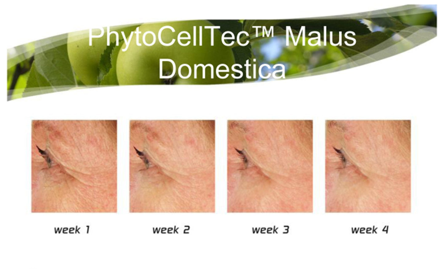 Anti-Aging. DIY Swiss Apple Stem Cell 100% Serum Booster. Remove Wrinkles, Rebuild Collagen & Elastin Beauty & Personal Care DNA Code